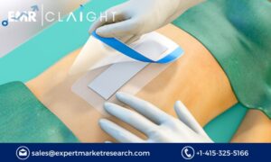 Surgical Dressing Market